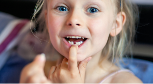 A little girl missing one tooth